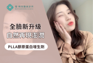 璧時尚台北醫美 填補蘋果肌與法令紋、改善臉部凹陷 療程前後對照