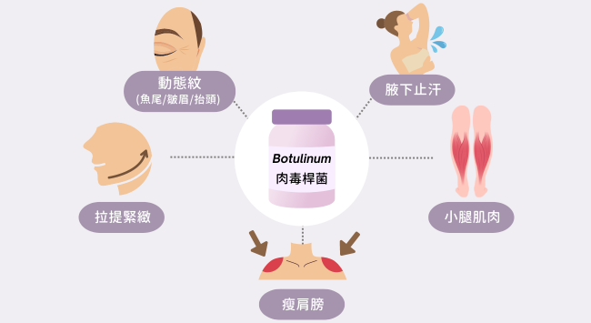 帶你了解肉毒醫美療程02 璧˙時尚醫美診所_服務項目_肉毒-肉毒術後-肉毒品牌-蘋果肌_淚溝_法令紋_皺紋_下顎線_高雄醫美_台中醫美_台北醫美_醫美推薦