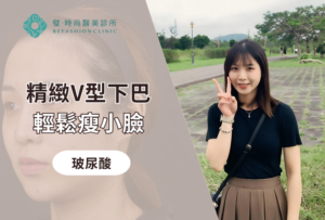璧時尚高雄醫美 填補法令紋、修飾下巴與下顎線輪廓 療程前後對照