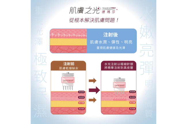 Derma Shine PRO 肌膚之光德瑪莎 (5) 璧˙時尚醫美診所_服務項目_蘋果肌-淚溝_法令紋_皺紋_立體唇珠-玻尿酸豐唇 _下顎線緊緻-下顎線_高雄醫美_玻尿酸培訓-海德密絲