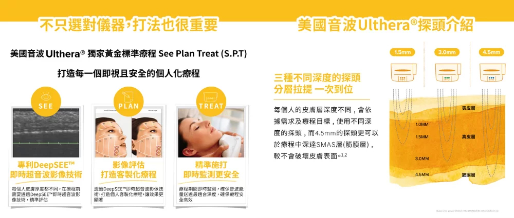 Ulthera-美國極線音波-4 璧˙時尚醫美診所_2026 緊緻拉提全攻略:鳳凰電波、美國音波、晶準極線音波差別在哪?醫師教你精準選對療程_線雕拉提_臉部拉提推薦_法令紋改善_輪廓線修飾_璧時尚診所_PDO線材_高雄醫美_台中醫美_台北醫美_醫美推薦