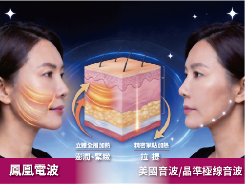 音波電波比較-01 璧˙時尚醫美診所_2026 緊緻拉提全攻略:鳳凰電波、美國音波、晶準極線音波差別在哪?醫師教你精準選對療程_線雕拉提_臉部拉提推薦_法令紋改善_輪廓線修飾_璧時尚診所_PDO線材_高雄醫美_台中醫美_台北醫美_醫美推薦