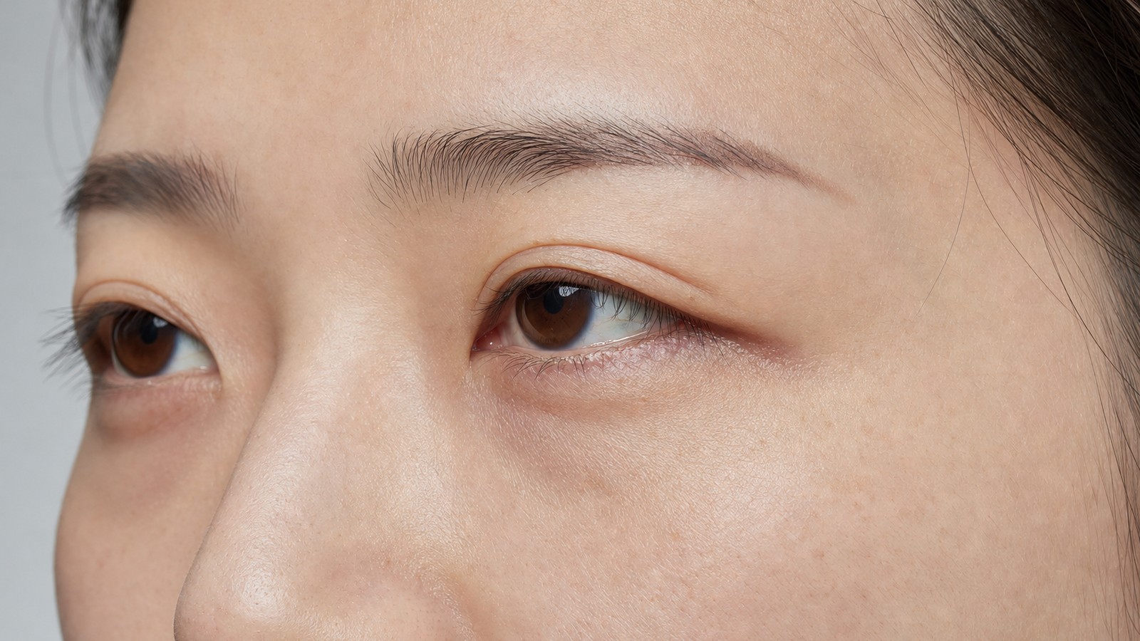 情境照:亞洲女性眼周特寫,示意魚尾紋、淚溝與眼窩凹陷的觀察區域