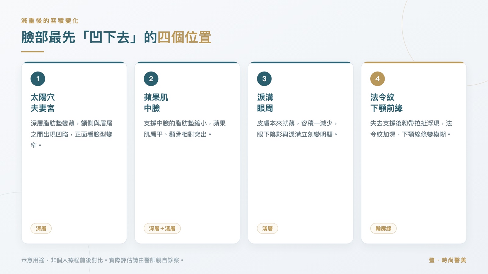 圖表:太陽穴夫妻宮、蘋果肌中臉、淚溝眼周、法令紋與下顎前緣四個位置